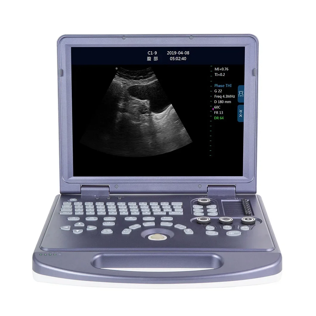 Китайские медицинские ультразвуковые инструменты портативный ветеринарный ультразвуковой сканер для беременных животных